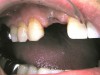 b-dental023