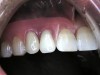 b_dental027